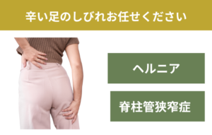 坐骨神経痛の対応