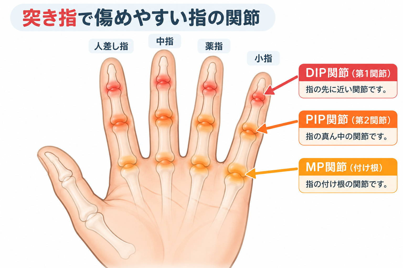 突き指が起こりやすい指の関節